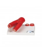 Arter çapraz kesitine sahip arterioskleroz model, 2 parçalı - 3B Smart Anatomy