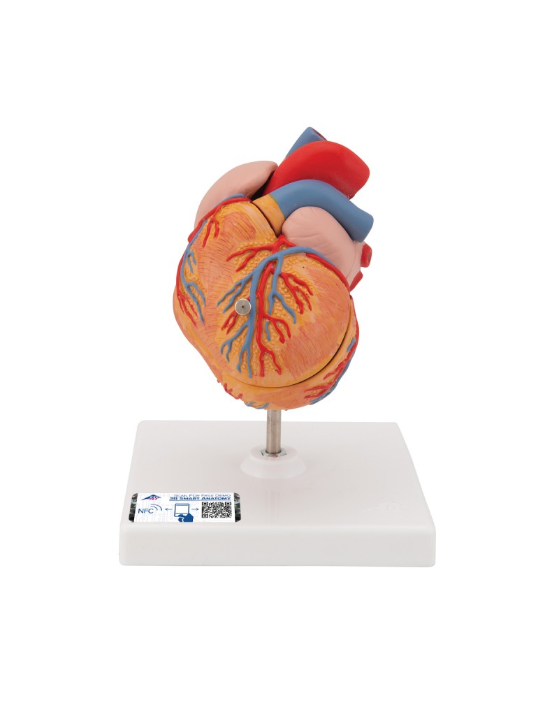 Sol ventriküler hipertrofi ile klasik kalp (LVH), 2 parçalı - 3B Smart Anatomy