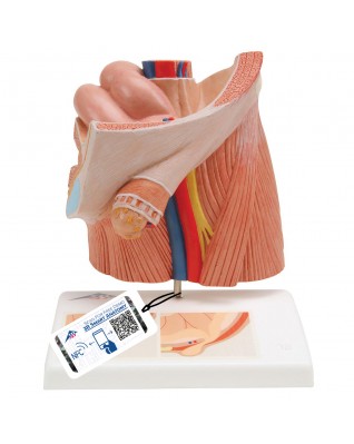 Fıtık modeli - 3B Smart Anatomy