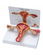 Uterus Modeli
