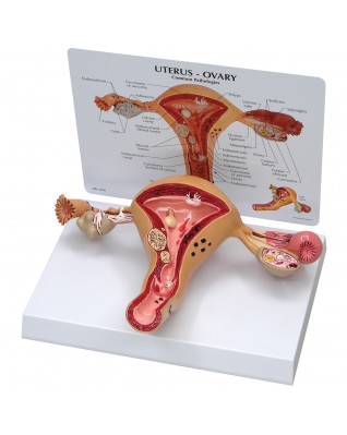 Uterus Modeli