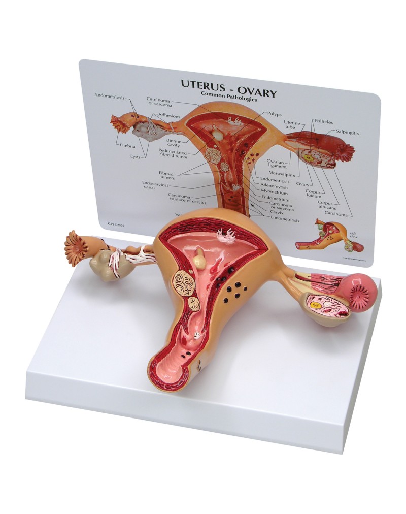 Uterus Modeli