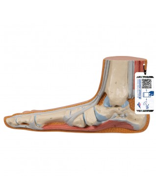 Düz taban (Pes planus) - 3B Smart Anatomy