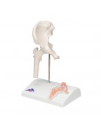 Çapraz kesitli mini kalça eklemi - 3B Smart Anatomy