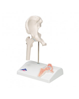 Çapraz kesitli mini kalça eklemi - 3B Smart Anatomy