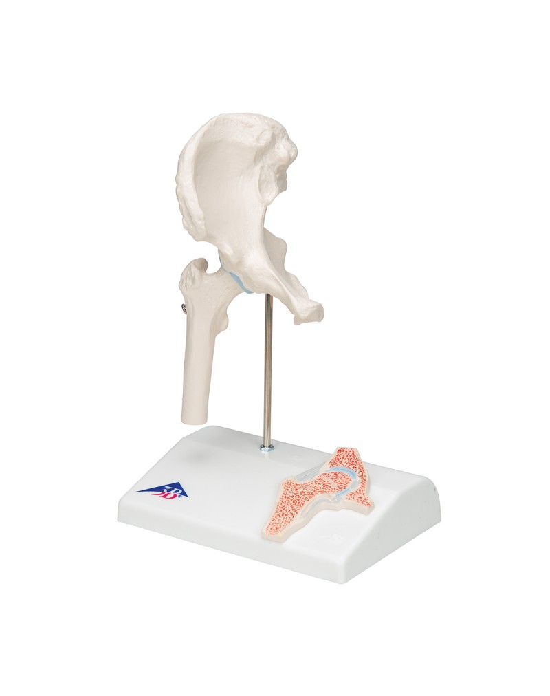 Çapraz kesitli mini kalça eklemi - 3B Smart Anatomy