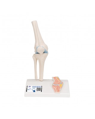Çapraz kesitli mini diz eklemi - 3B Smart Anatomy