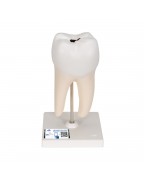 Alt Azı Dişi Modeli - 2 parça - 3B Smart Anatomy