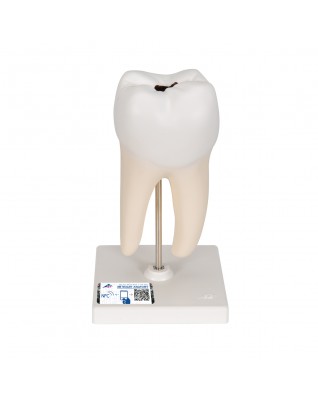 Alt Azı Dişi Modeli - 2 parça - 3B Smart Anatomy