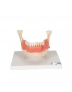 Diş Hastalıkları Modeli - 21 parça, 2 kat büyütülmüş - 3B Smart Anatomy