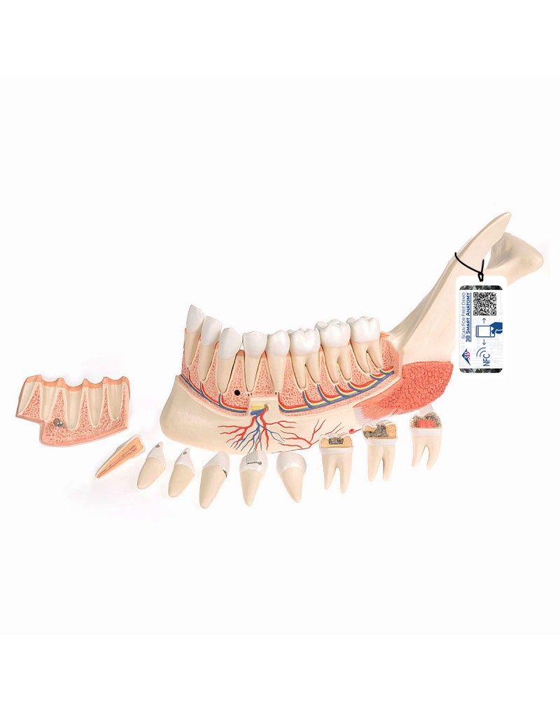Alt Çene Modeli - 19 parça, 8 çürük dişli - 3B Smart Anatomy