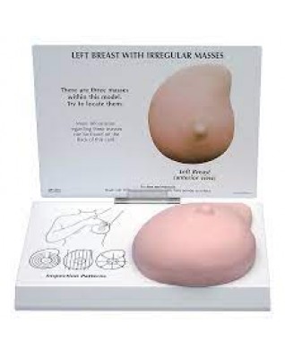 Left Breast Model with Irregular Masses
