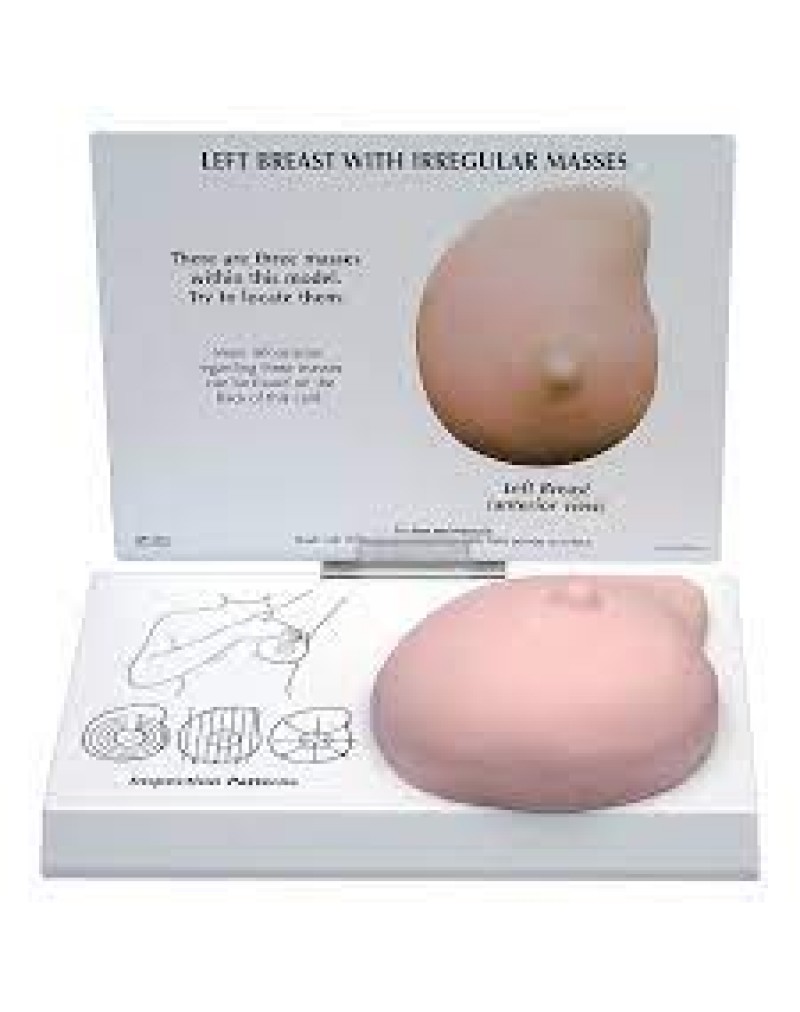 Left Breast Model with Irregular Masses