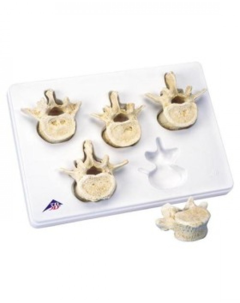 5 bel omuruna sahip set - 3B Smart Anatomy