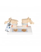 Osteoporoz modeli - 3B Smart Anatomy