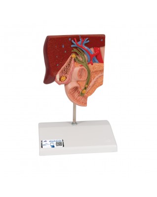 Safra taşı modeli - 3B Smart Anatomy