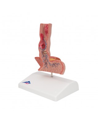 Yemek borusu hastalıkları - 3B Smart Anatomy