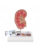 Böbrek taşı modeli - 3B Smart Anatomy