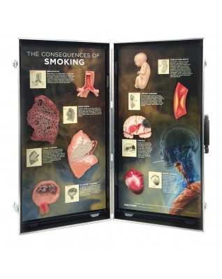Consequences of Smoking, 3D Info Board