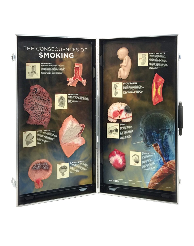 Consequences of Smoking, 3D Info Board
