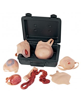 Neonatal Yara Kiti