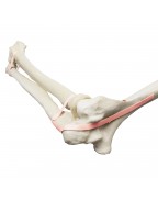 ORTHObones Lateks bağ ile Diz Eklemi