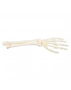 ORTHObones Sol Bilek