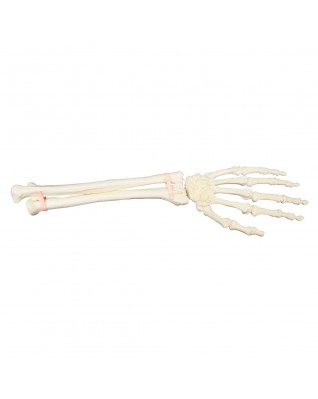 ORTHObones Sol Bilek