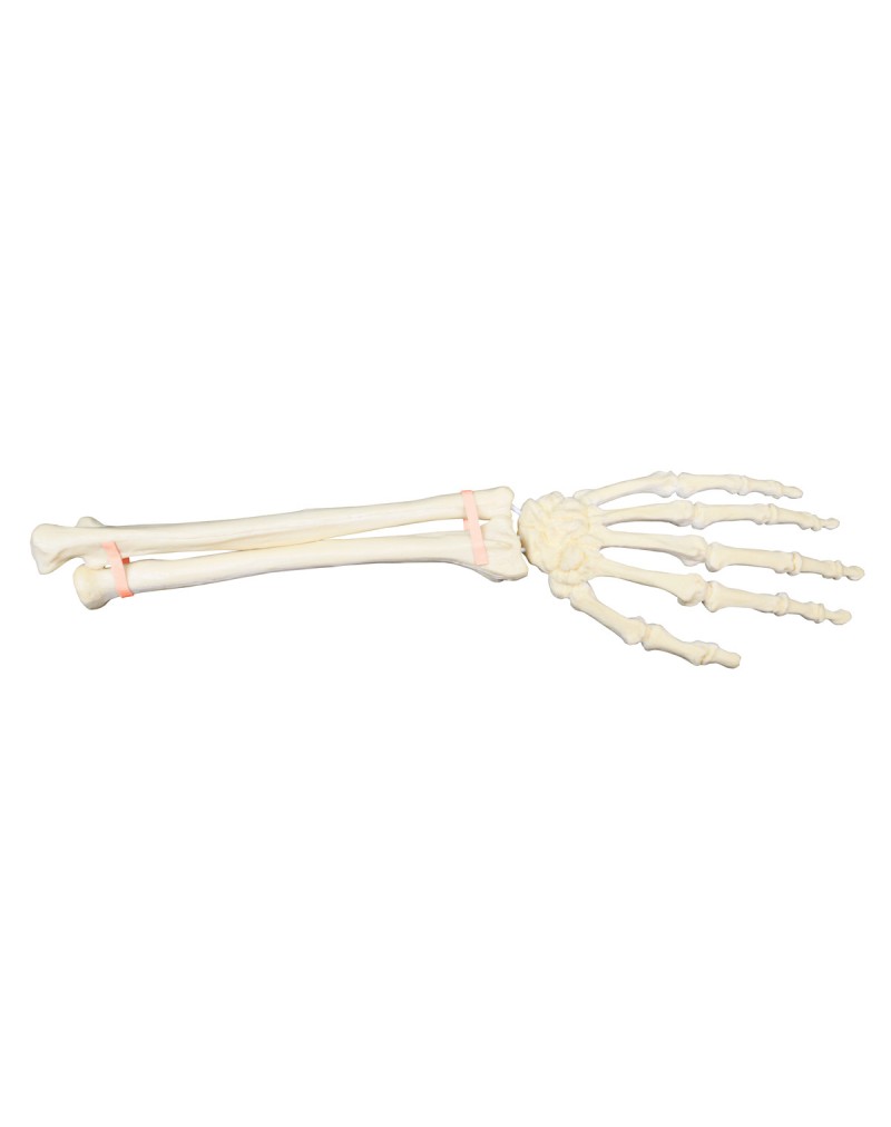 ORTHObones Sol Bilek