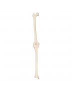 ORTHObones Sol Diz