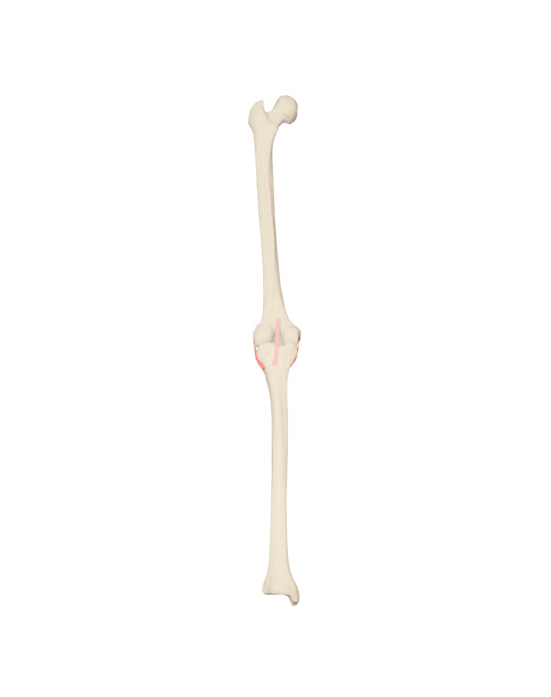 ORTHObones Sol Diz