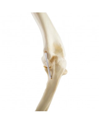 ORTHObones Standard Elbow elastic bands l