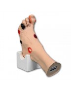 Wilma Wound Foot™