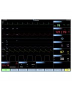 CARESCAPETM B40 Patient Monitor Screen Simulation for REALITi 360