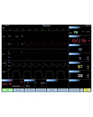 CARESCAPETM B40 Patient Monitor Screen Simulation for REALITi 360