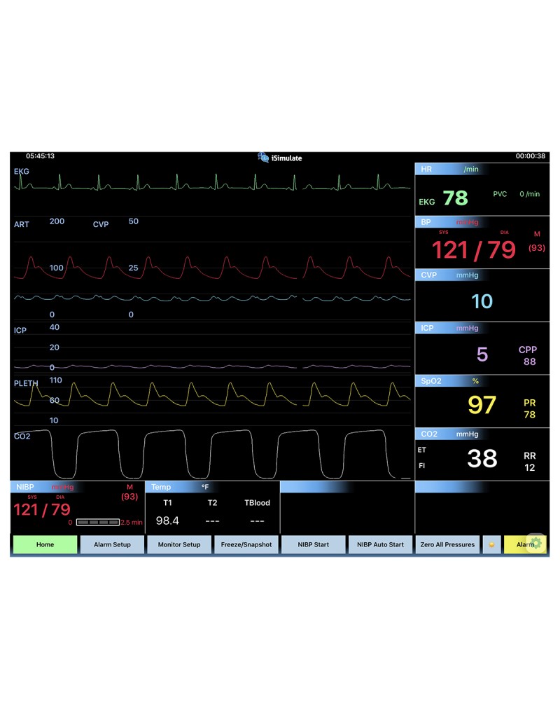 CARESCAPETM B40 Patient Monitor Screen Simulation for REALITi 360