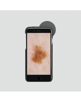 HEINE® iC1 Dermatoscope