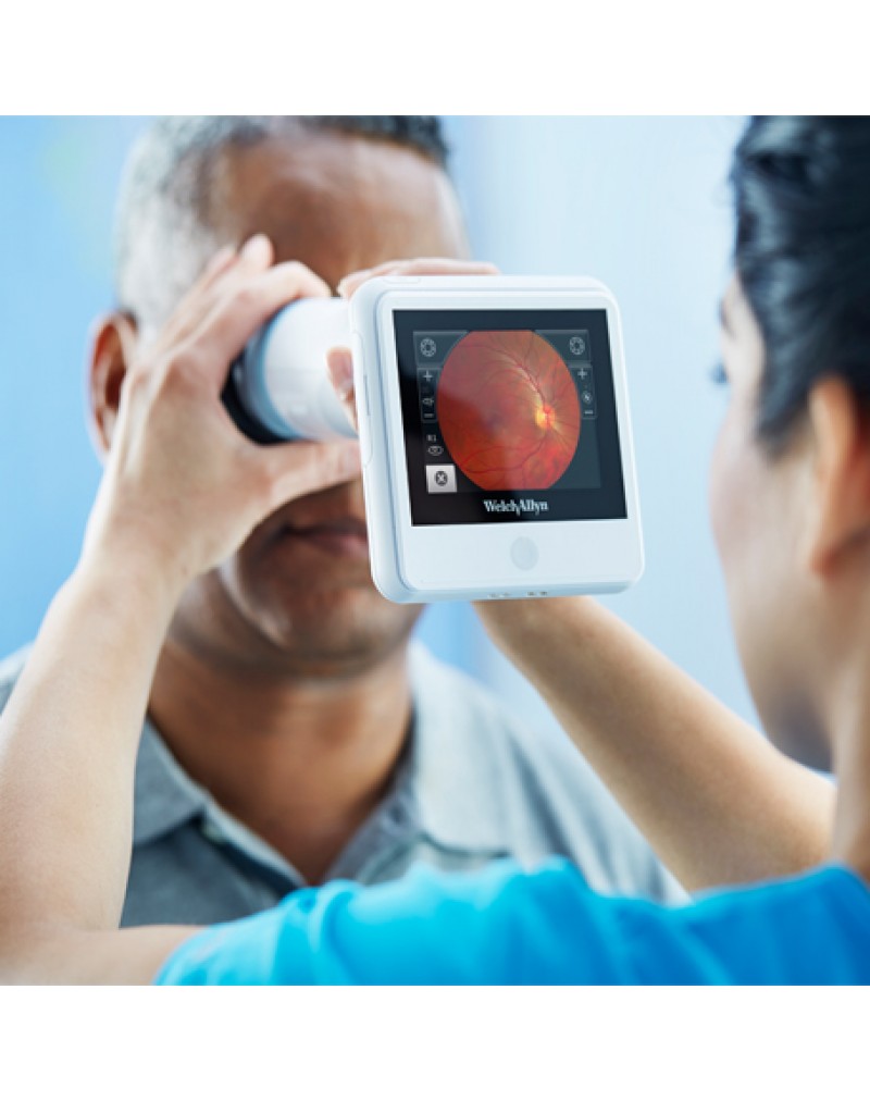 Welch Allyn RetinaVue® 100 Imager Retinal Kamera