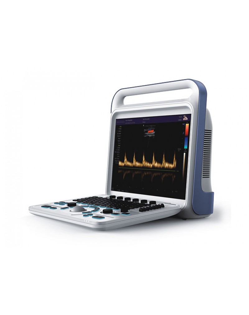 S8i Color Portable Ultrasound Scanner