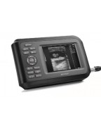Sono R palm ultrasound scanner