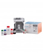 SOLUNUM YOLU ENFEKSİYON TESTLERİ-COVID-19 IgG ELISA
