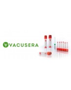 Serum Tüpleri