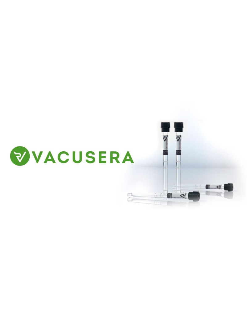 Vacusera Sedimentasyon Tüpleri